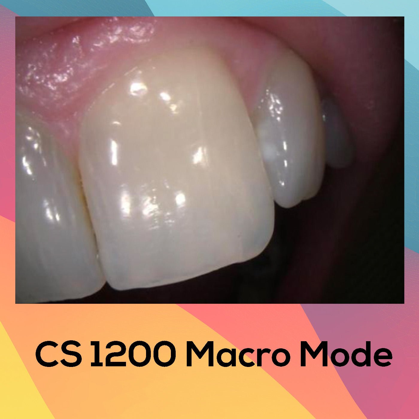 
                  
                    Carestream CS1200 Intra Oral Camera - 360visualise
                  
                