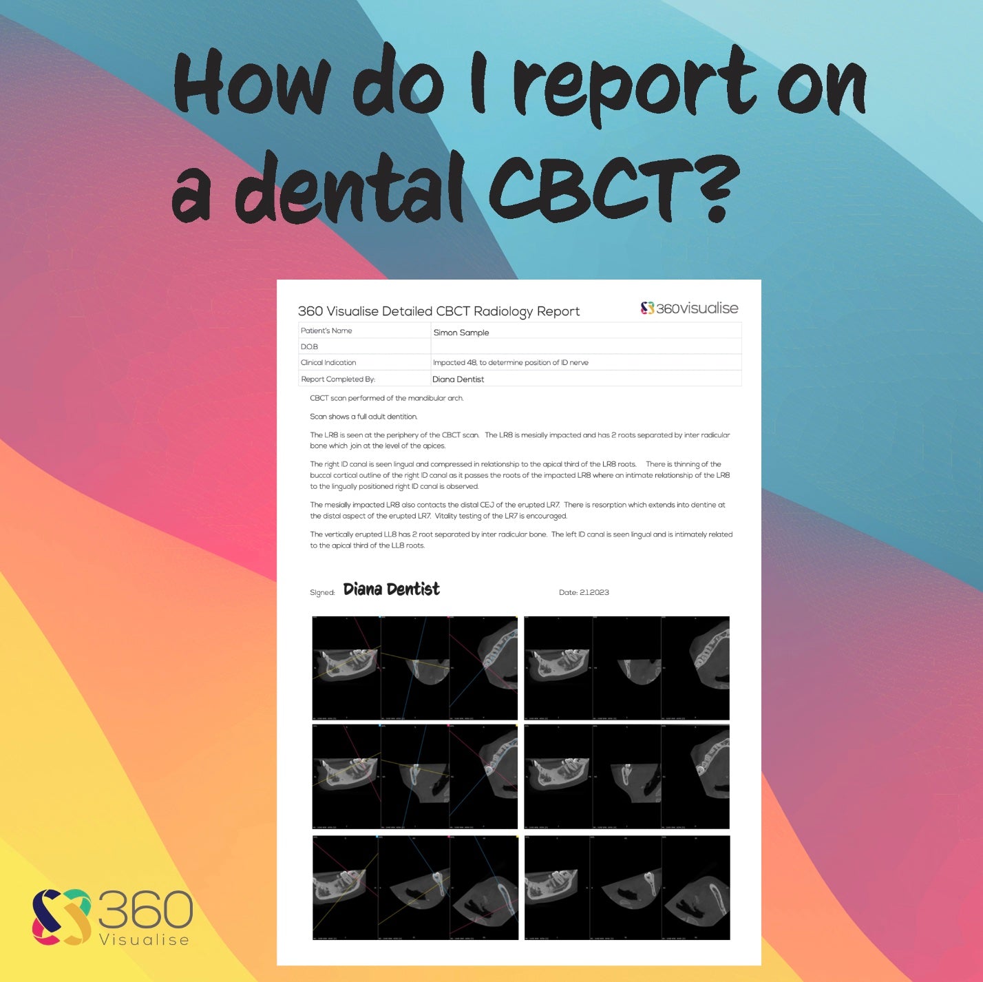 How report on dental CBCT.