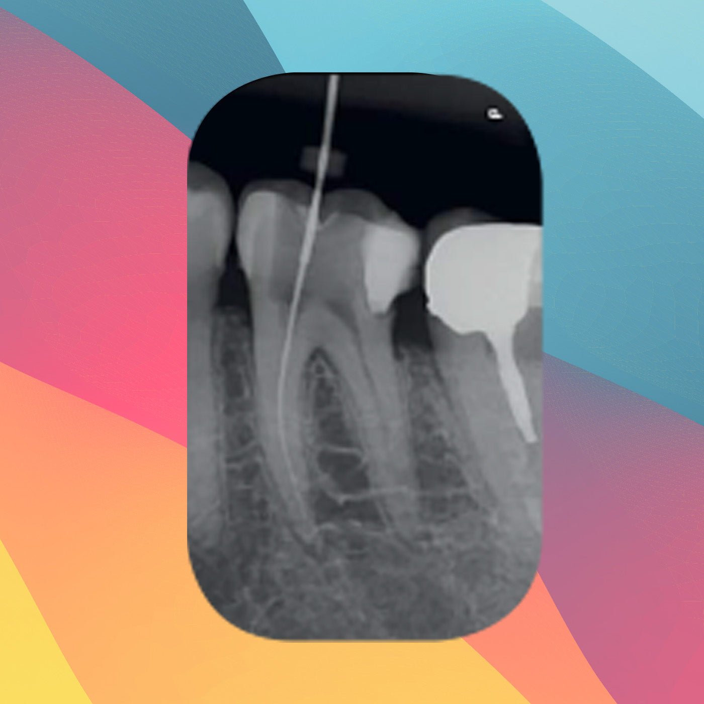
                  
                    Acteon PSPIX²® Phosphor Plate Digital Intra Oral Xray Scanner - 360visualise
                  
                