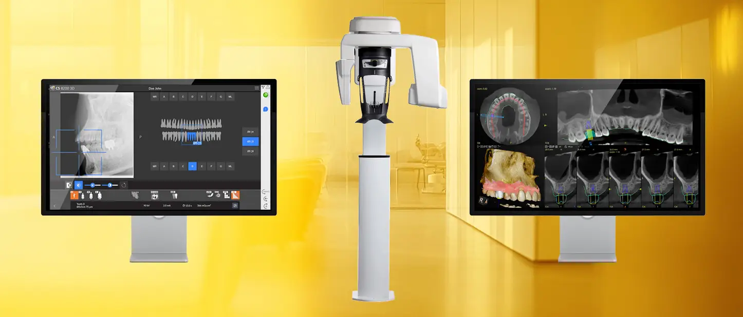 Carestream CS1200 - 360 Visualise