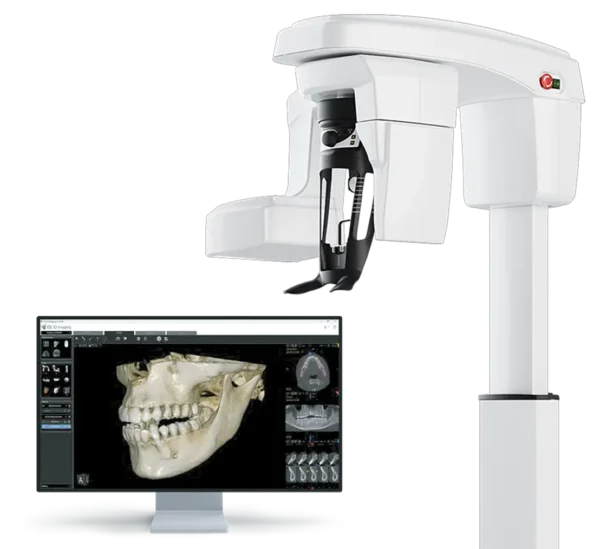 Carestream CS8200 Advanced