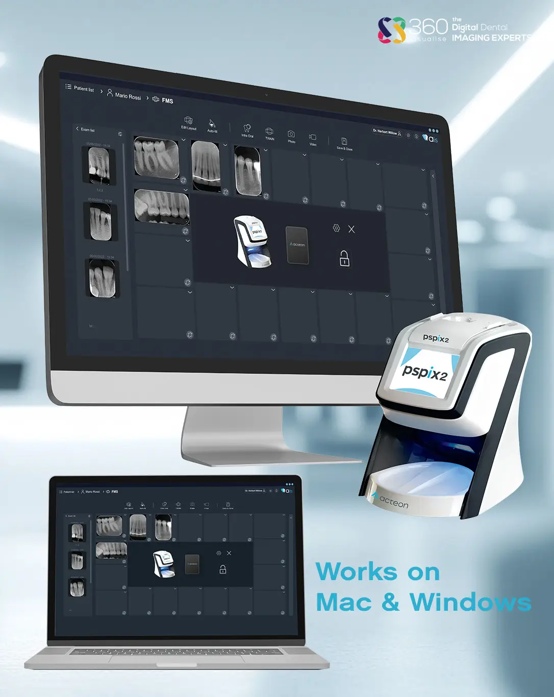 Acteon PSPIX2 with SOPRO Imaging software running on a Mac