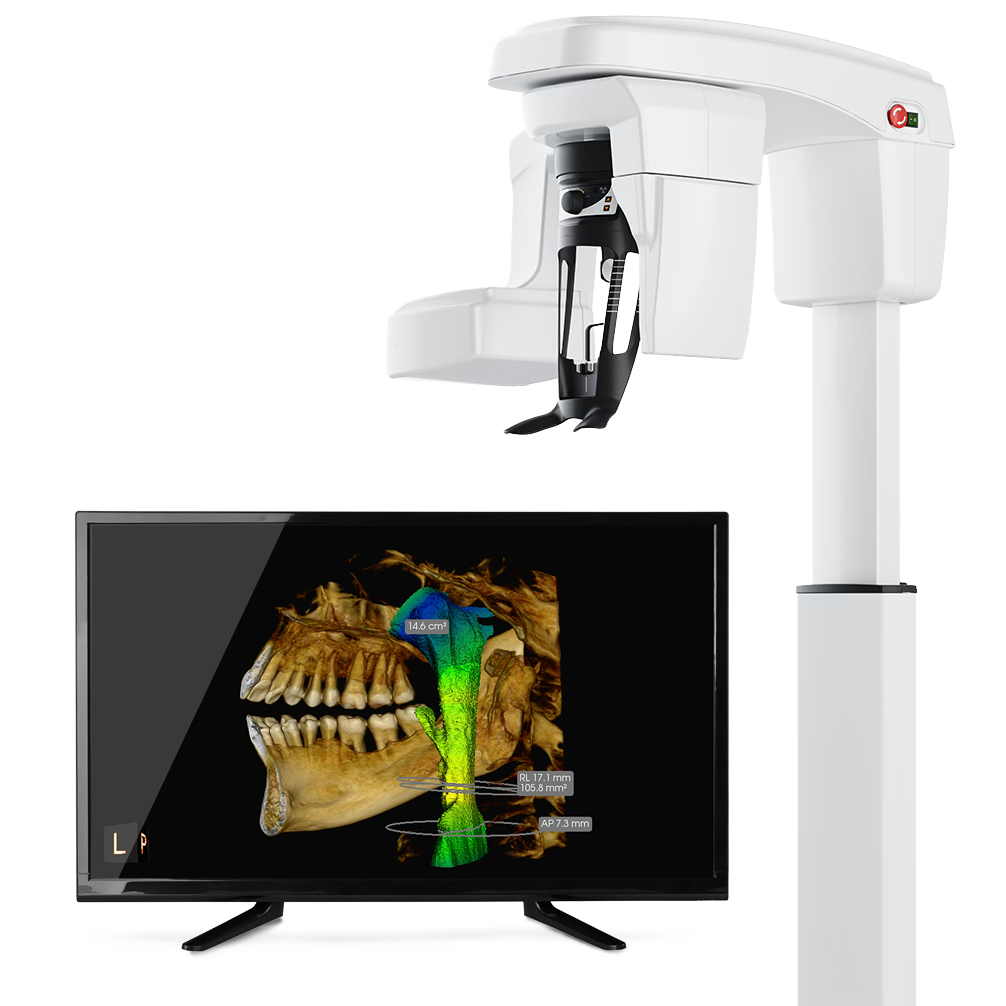 CS8200 3D Family Advance