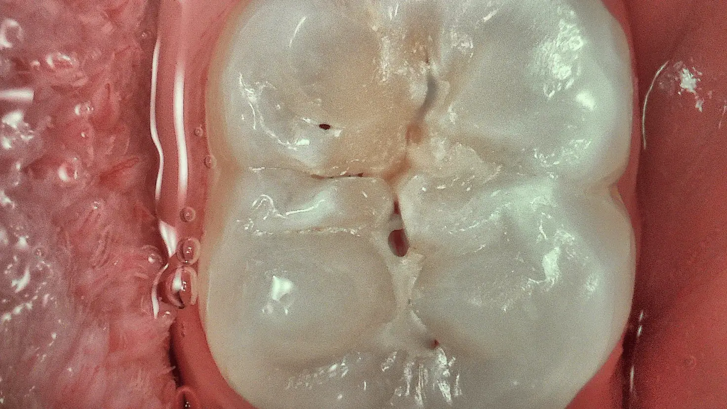 Acteon C50 Daylight+ enhanced mode – improved anatomical detail