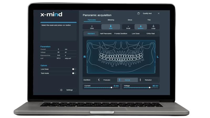 Acteon AIS software interface for X-MIND Prime panoramic imaging
