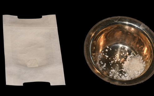 Collagen membrane and bone graft material prepared for the regenerative procedure