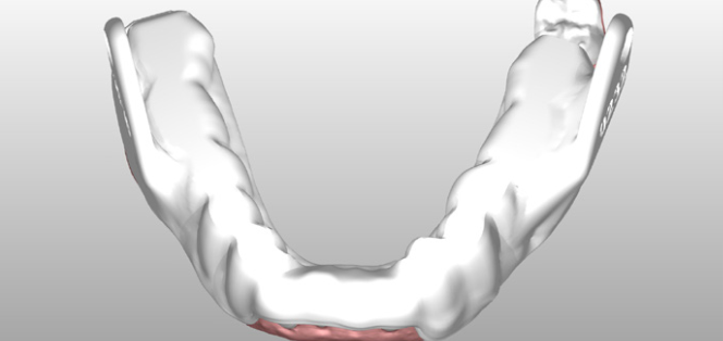 Narval CC appliance design — virtual articulator view