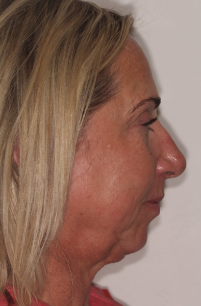 Clinical evaluation photographs