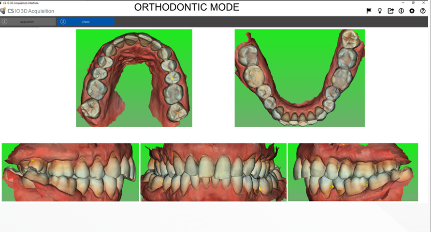 Intraoral scan with multiple bite registrations in CS 3600 software