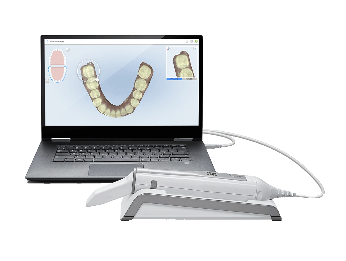 iTero Element Flex intraoral scanner