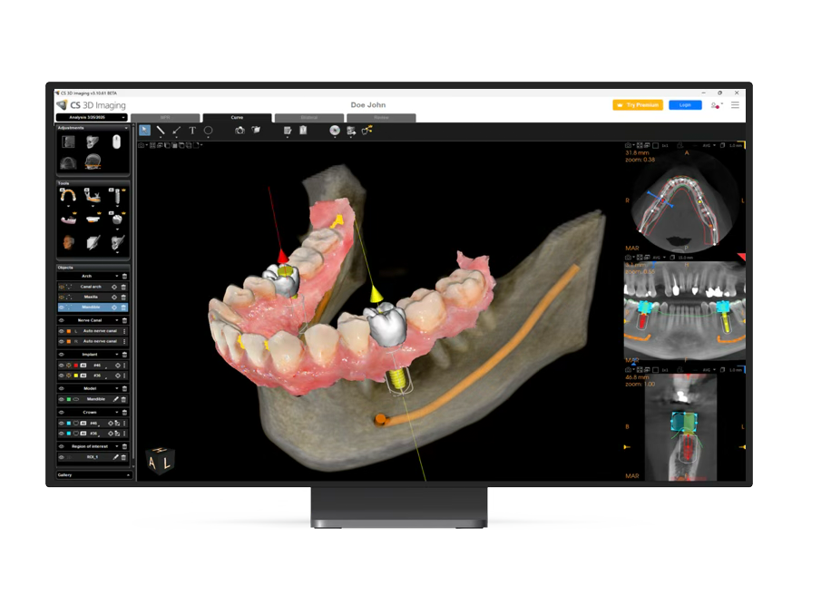 CS 3D Imaging Premium &mdash; AI-powered implant planning software
