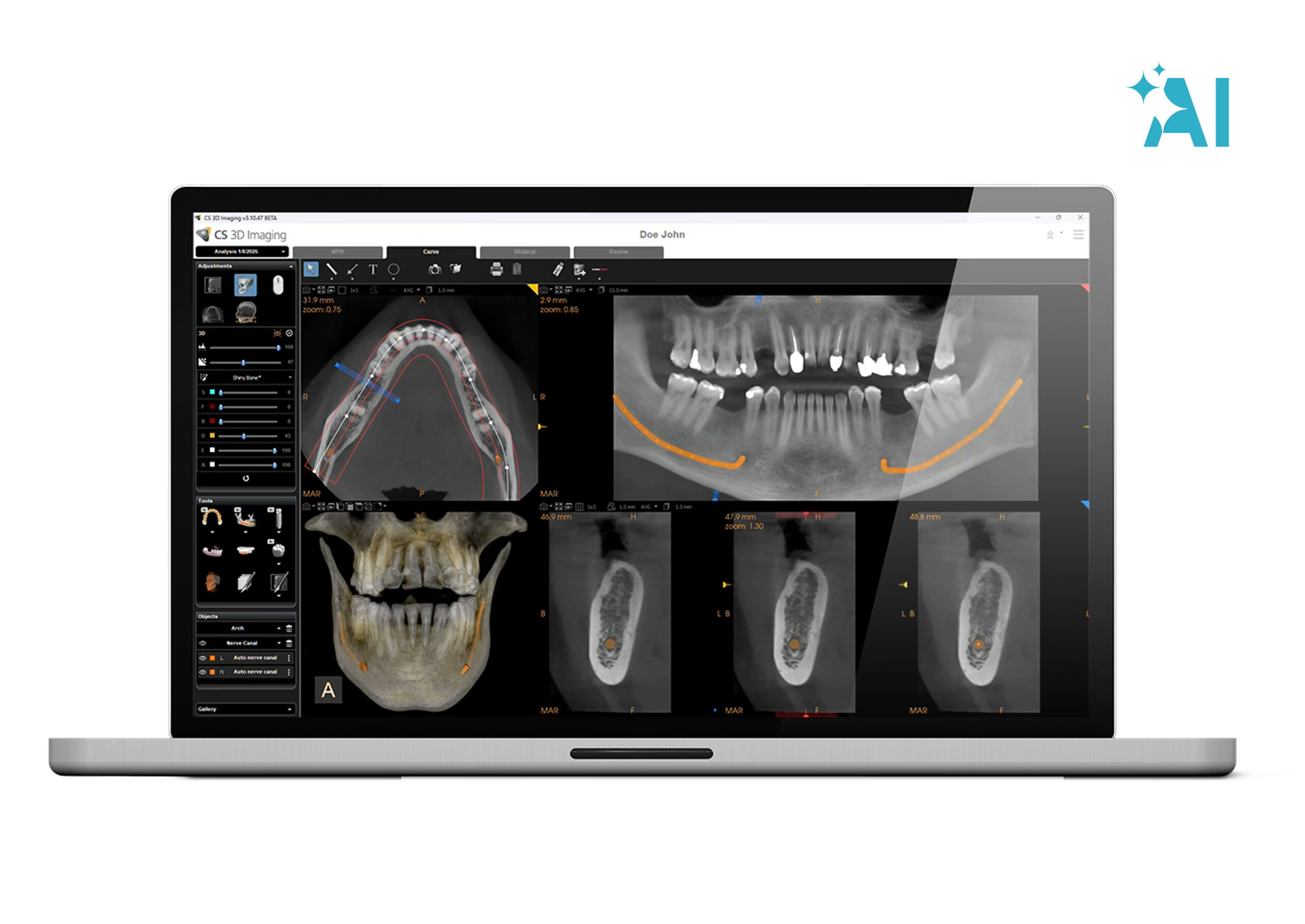Step 1 &mdash; Prepare data