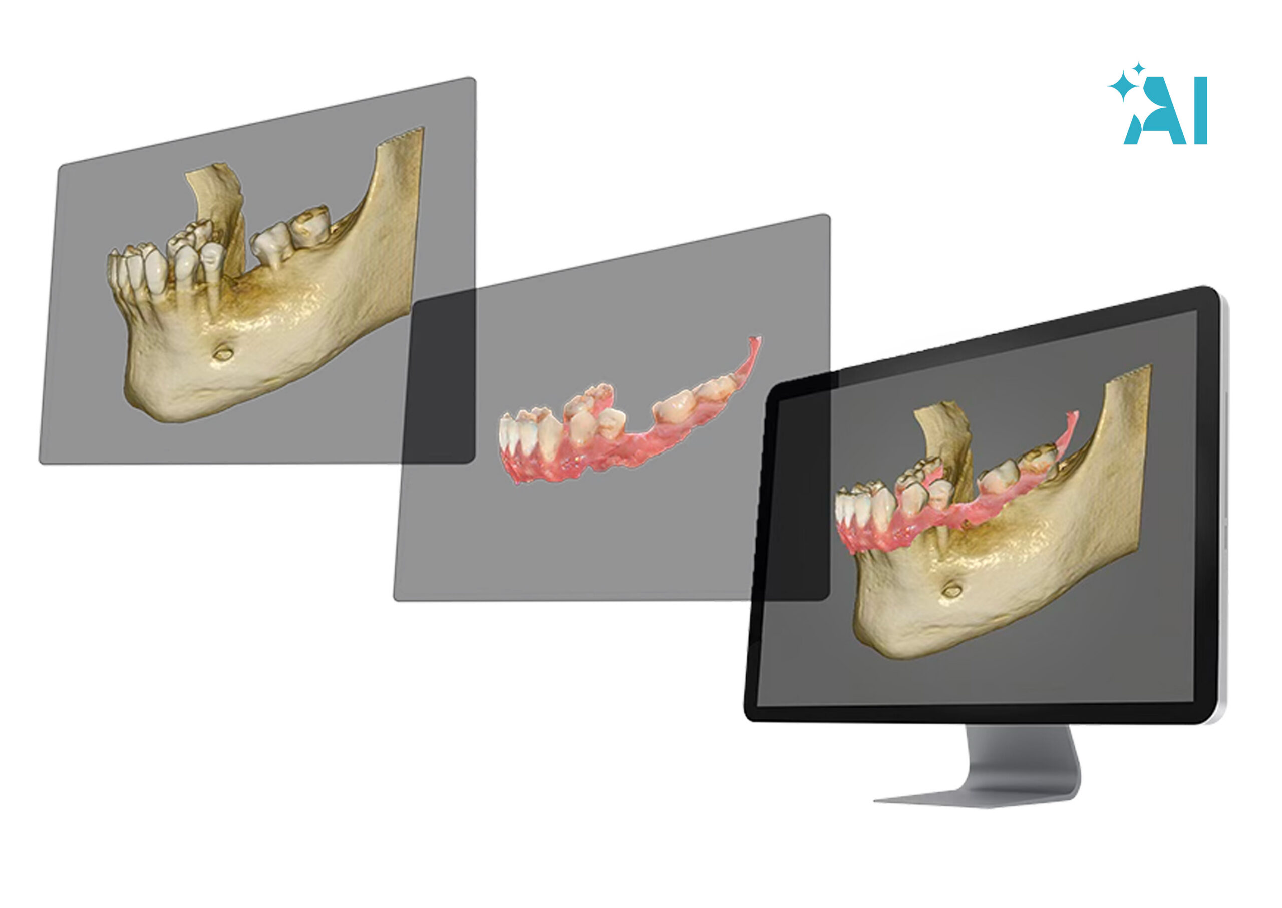 Step 2 &mdash; Merge data