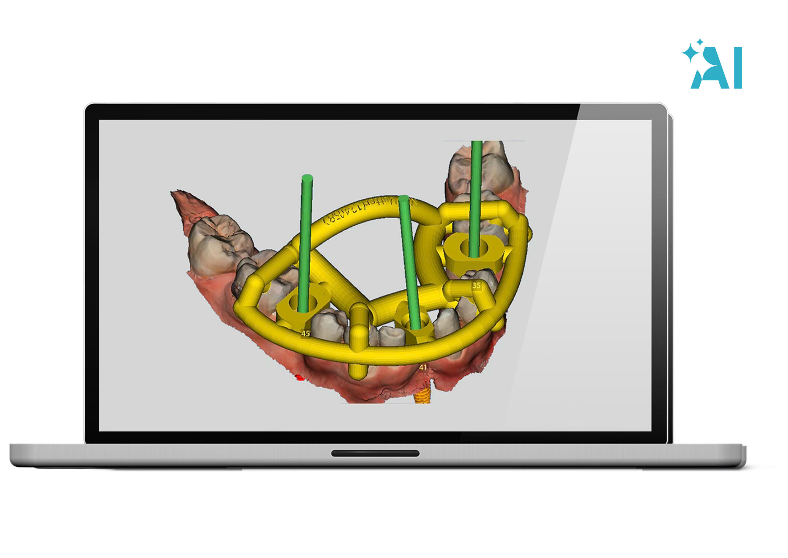 Step 4 &mdash; Create guide