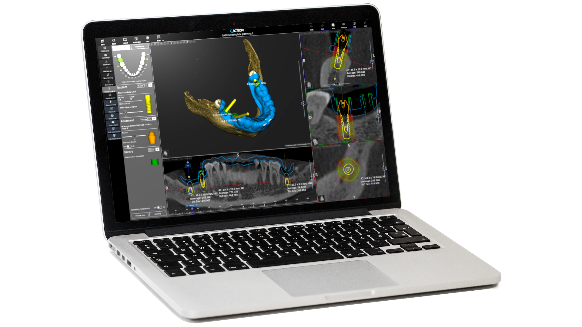 Acteon Imaging Suite (AIS) software interface
