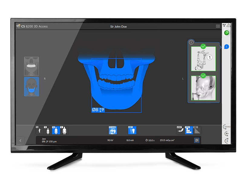 CS Imaging easy-setup workflow