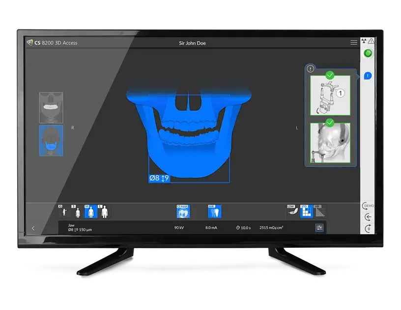 CS Imaging acquisition screen showing field of view selection on a skull