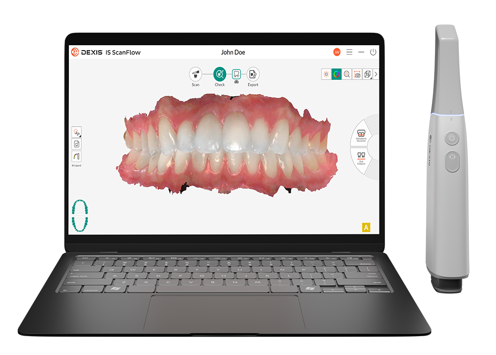 DEXIS Imprevo intraoral scanner with laptop