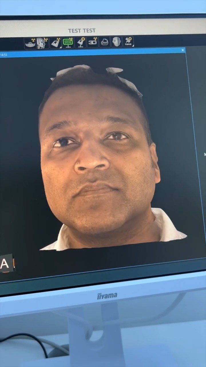 3D face scan result from the Carestream CS 9600 at Alban City Dental Care