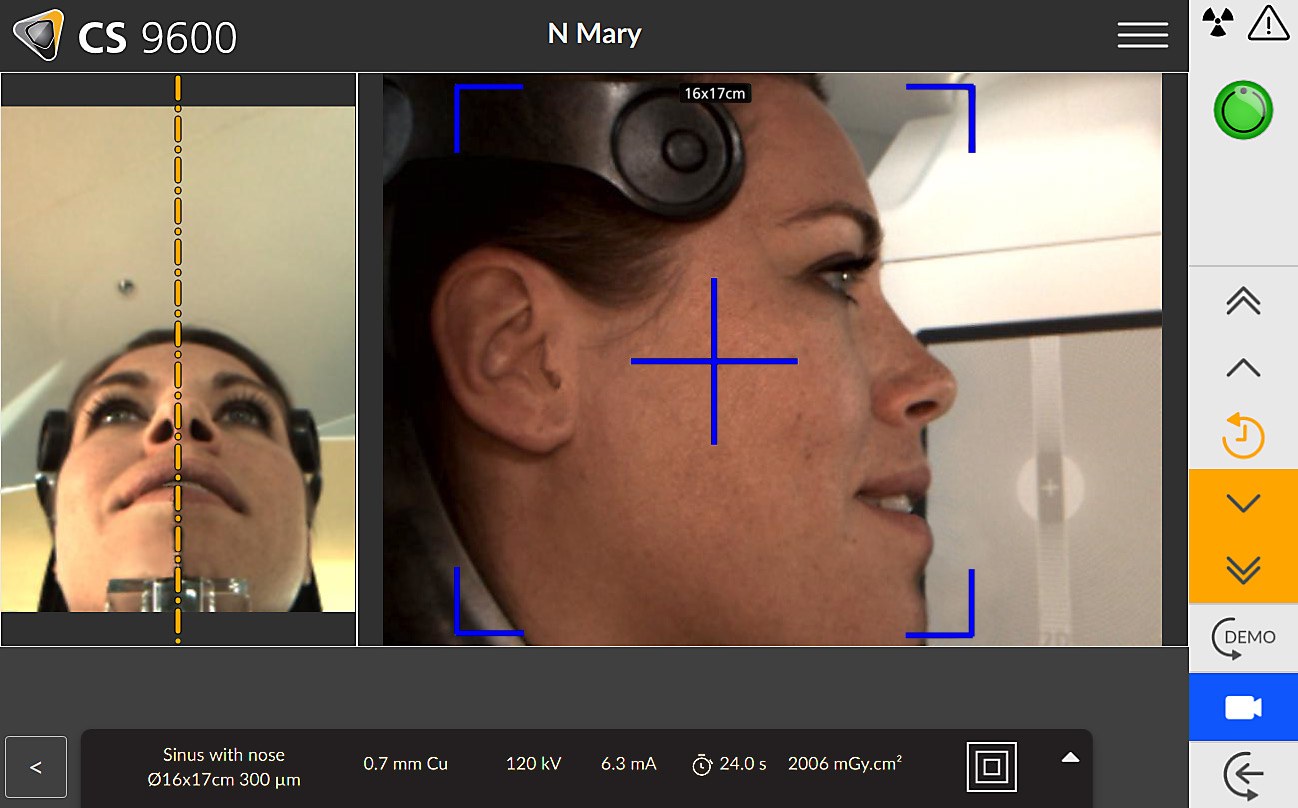 Carestream CS 9600 touch screen showing live camera positioning of a patient