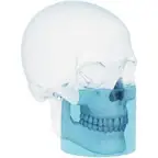 Carestream CBCT 10 &times; 10 cm field of view