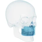 Carestream CBCT 8 &times; 5 cm field of view