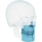 Carestream CBCT 8 &times; 9 cm field of view